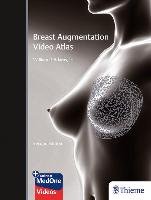 Breast Augmentation Video Atlas Thieme Georg Verlag, Thieme Medical Publishers