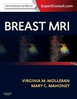 Breast MRI Molleran Virginia, Mahoney Mary C.