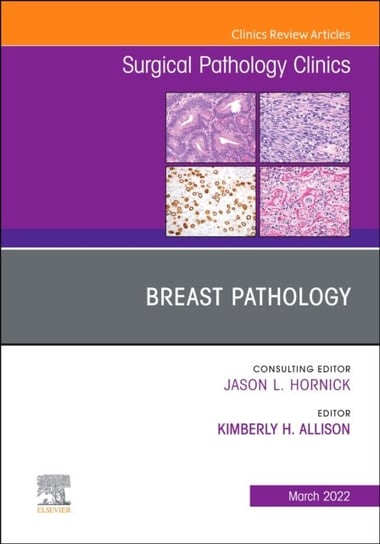 Breast Pathology, An Issue of Surgical Pathology Clinics Opracowanie zbiorowe