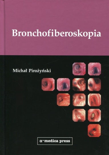 Bronchofiberoskopia Pirożyński Michał