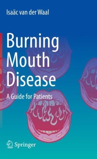 Burning Mouth Disease: A Guide for Patients Isaac van der Waal