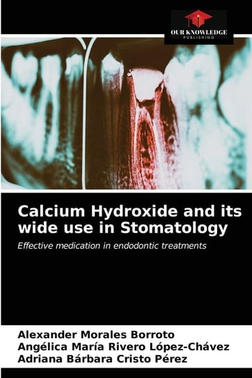 Calcium Hydroxide and its wide use in Stomatology Morales Borroto Alexander