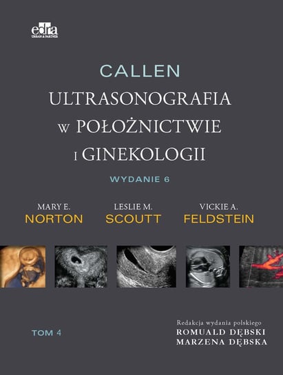 Callen. Ultrasonografia w położnictwie i ginekologii. Tom 4 Scoutt L.M., Norton M.E., Feldstein V.A.