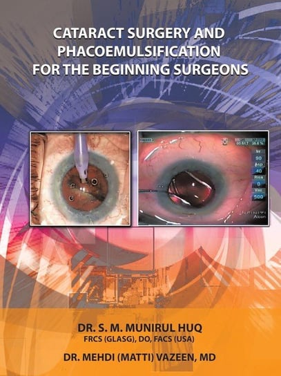 Cataract Surgery And Phacoemulsification For The Beginning Surgeons Huq Dr.S.M.Munirul