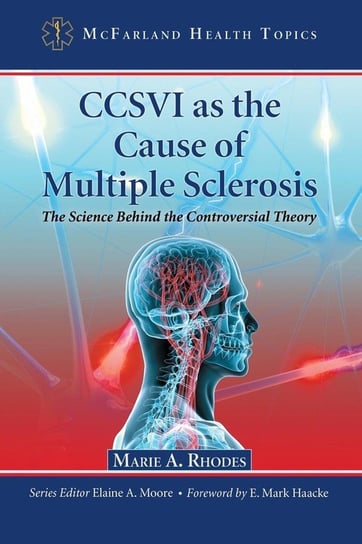 CCSVI as the Cause of Multiple Sclerosis Rhodes Marie A