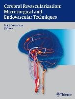 Cerebral Revascularization: Microsurgical and Endovascular Techniques Nussbaum Eric, Mocco J.
