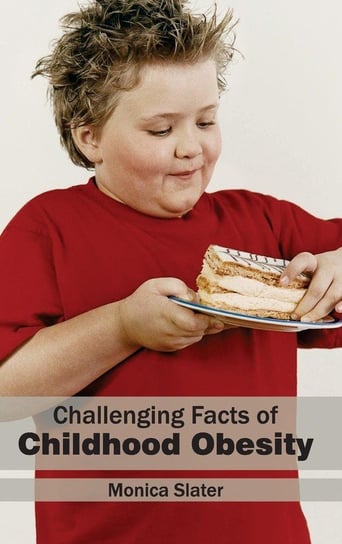 Challenging Facts of Childhood Obesity M L Books International Pvt Ltd