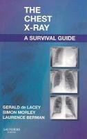 Chest X-Ray: A Survival Guide Lacey Gerald