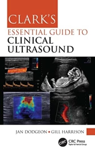 Clark's Essential Guide to Clinical Ultrasound Jan Dodgeon