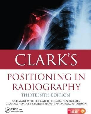 Clark's Positioning in Radiography Opracowanie zbiorowe