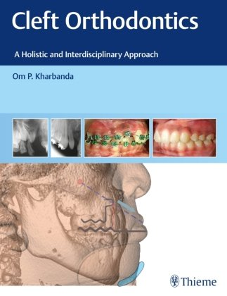 Cleft Orthodontics Thieme, Stuttgart