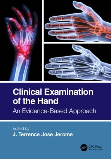 Clinical Examination of the Hand. An Evidence-Based Approach Opracowanie zbiorowe