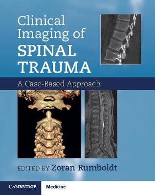 Clinical Imaging of Spinal Trauma Rumboldt Zoran, Cianfoni Alessandro, Varma Abhay
