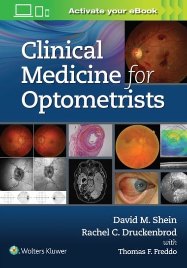 Clinical Medicine for Optometrists David Shein