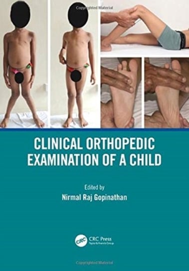 Clinical Orthopedic Examination of a Child Opracowanie zbiorowe
