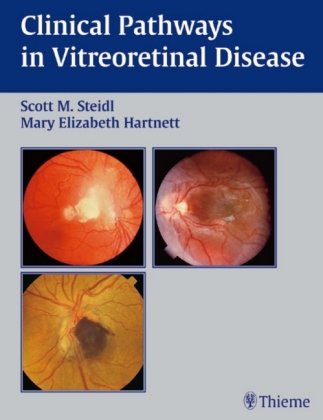 Clinical Pathways in Vitreoretinal Disease Thieme Medical Publ Inc., Thieme Medical Publishers Inc.