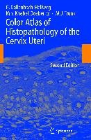 Color Atlas of Histopathology of the Cervix Uteri Dallenbach-Hellweg Gisela, Knebel Doeberitz Magnus, Trunk Marcus J.