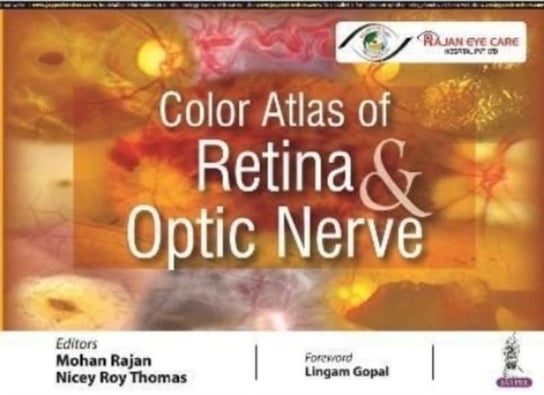 Color Atlas of Retina & Optic Nerve Mohan Rajan, Nicey Roy Thomas