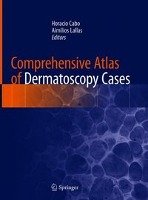 Comprehensive Atlas of Dermatoscopy Cases Springer-Verlag Gmbh, Springer International Publishing