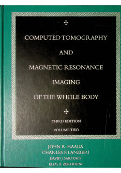Computed tomography and magnetic resonance imaging of the whole body ...