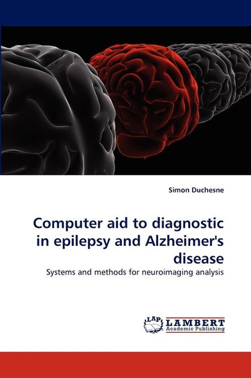 Computer aid to diagnostic in epilepsy and Alzheimer's disease ...