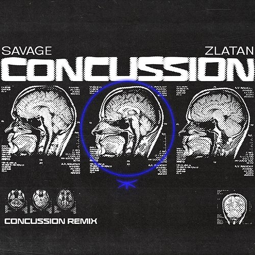 Concussion Savage & Zlatan