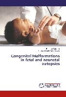 Congenital Malformations in fetal and neonatal autopsies Kale Jain Pradnya, Atul Hulwan Sujata Kanetkar