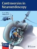 Controversies in Neuroendoscopy Nakaji Peter, Zaidi Hasan A.