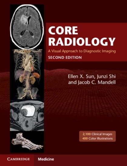 Core Radiology. A Visual Approach to Diagnostic Imaging Opracowanie zbiorowe