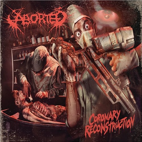 Coronary Reconstruction - EP Aborted