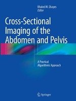 Cross-Sectional Imaging of the Abdomen and Pelvis Springer-Verlag New York Inc., Springer Us New York N.Y.