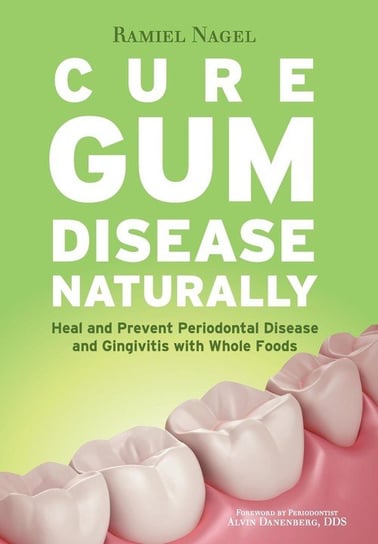 Cure Gum Disease Naturally Nagel Ramiel