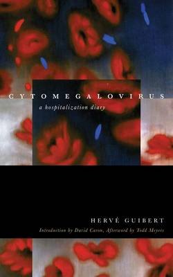 Cytomegalovirus: A Hospitalization Diary Guibert Herve