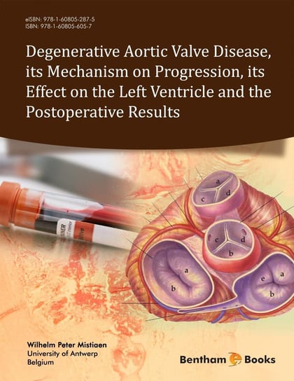 Degenerative Aortic Valve Disease, its Mechanism on Progression, its Effect on the Left Ventricle and the Postoperative Results Wilhelm Peter Mistiaen