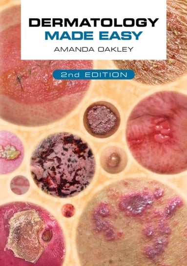 Dermatology Made Easy, second edition Opracowanie zbiorowe