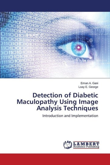 Detection of Diabetic Maculopathy Using Image Analysis Techniques Gani Eman A.