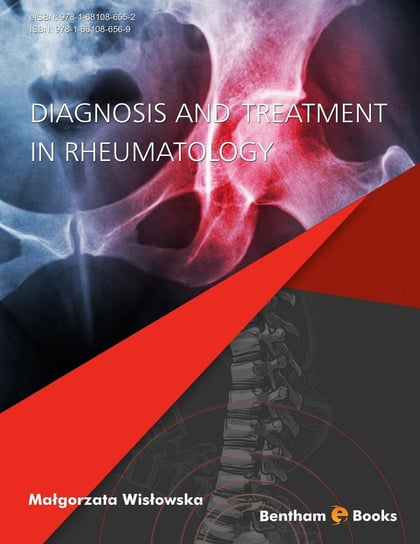 Diagnosis and Treatment in Rheumatology Malgorzata Wislowska