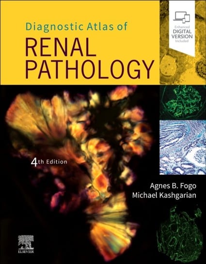 Diagnostic Atlas of Renal Pathology Opracowanie zbiorowe