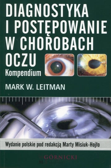 Diagnostyka i postępowanie w chorobach oczu. Kompendium Leitman Mark W.