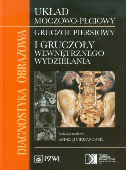 Diagnostyka obrazowa. Układ moczowo-płciowy, gruczoł piersiowy i gruczoły wewnętrznego wydzielania Opracowanie zbiorowe