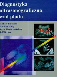 Diagnostyka ultrasonograficzna wad płodu Entezami Michael, Albig Matthias, Gasiorek-Wiens Adam