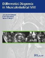 Differential Diagnosis in Musculoskeletal MRIAutoren: Gary M. Hollenberg / Eric P. Weinberg / Steven P. Meyers Weinberg Eric, Meyers Steven, Hollenberg Gary M.