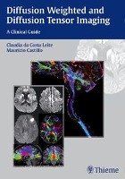 Diffusion Weighted and Diffusion Tensor Imaging Thieme Georg Verlag, Thieme Medical Publishers