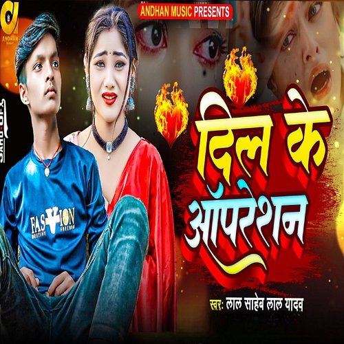 Dil Ke Operation Lal Saheb Lal Yadav