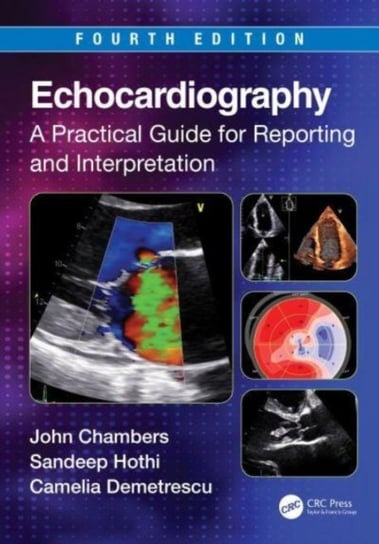 Echocardiography: A Practical Guide for Reporting and Interpretation Opracowanie zbiorowe