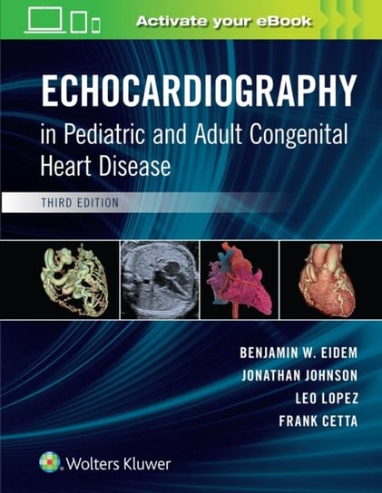Echocardiography in Pediatric and Adult Congenital Heart Disease Opracowanie zbiorowe