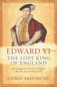 Edward VI Chris Skidmore