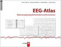 EEG-Atlas Blume Warren T., Holloway Giannina M., Kaibara Masako, Young Bryan G.