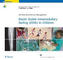Elastic Stable Intramedullary Nailing (ESIN) in Children mit DVD Illing Peter, Lascombes Pierre