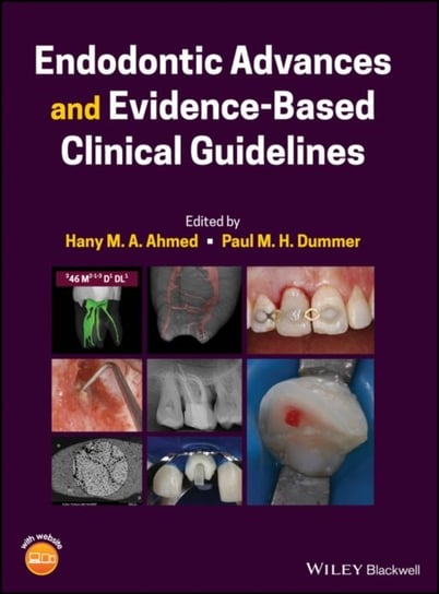 Endodontic Advances and Evidence-Based Clinical Guidelines John Wiley & Sons